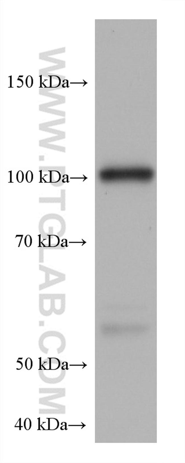 HK3 Antibody in Western Blot (WB)