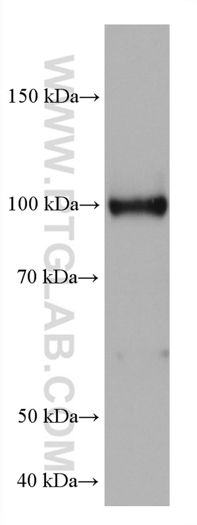 HK3 Antibody in Western Blot (WB)