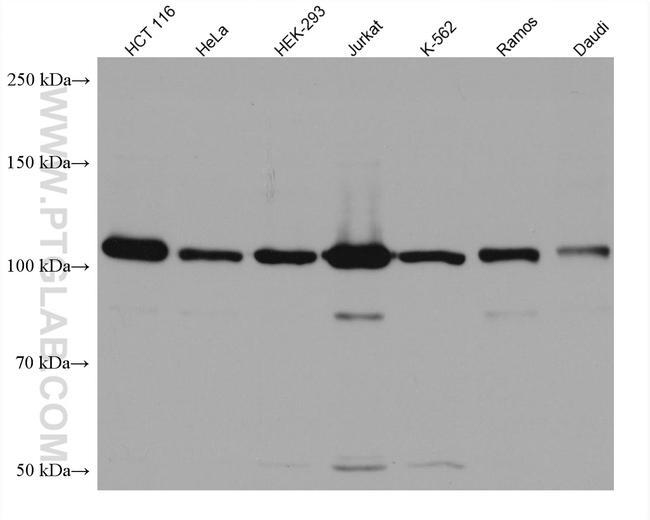 USP11 Antibody in Western Blot (WB)