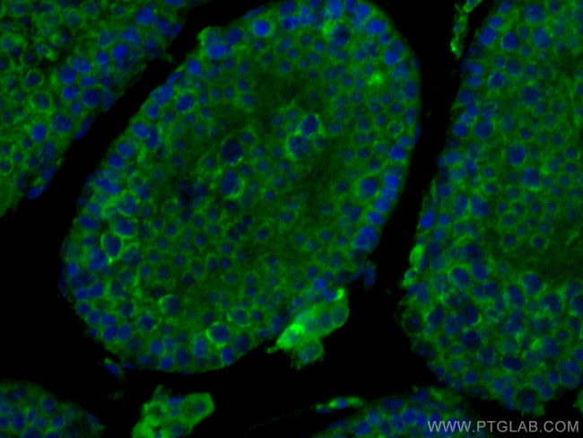 SMCR7L Antibody in Immunohistochemistry (Paraffin) (IHC (P))