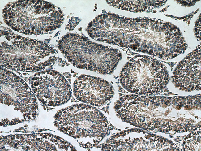 SMCR7L Antibody in Immunohistochemistry (Paraffin) (IHC (P))