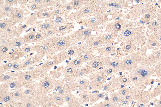 PPP2CA Antibody in Immunohistochemistry (Paraffin) (IHC (P))