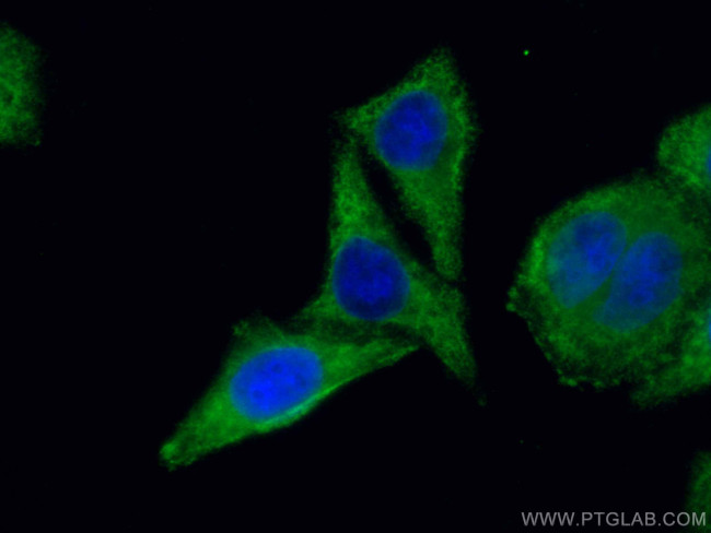 LARP1 Antibody in Immunocytochemistry (ICC/IF)