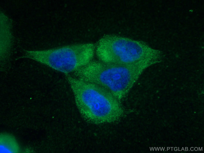 LARP1 Antibody in Immunocytochemistry (ICC/IF)