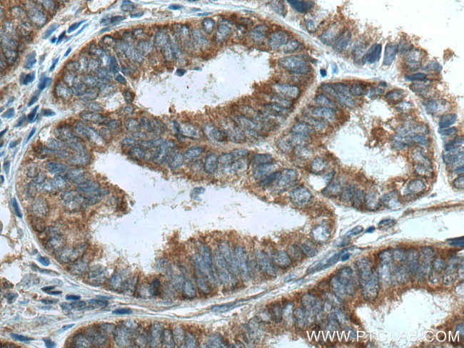 LARP1 Antibody in Immunohistochemistry (Paraffin) (IHC (P))