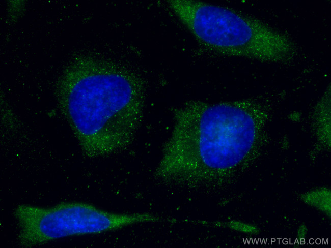 FXR1 Antibody in Immunocytochemistry (ICC/IF)