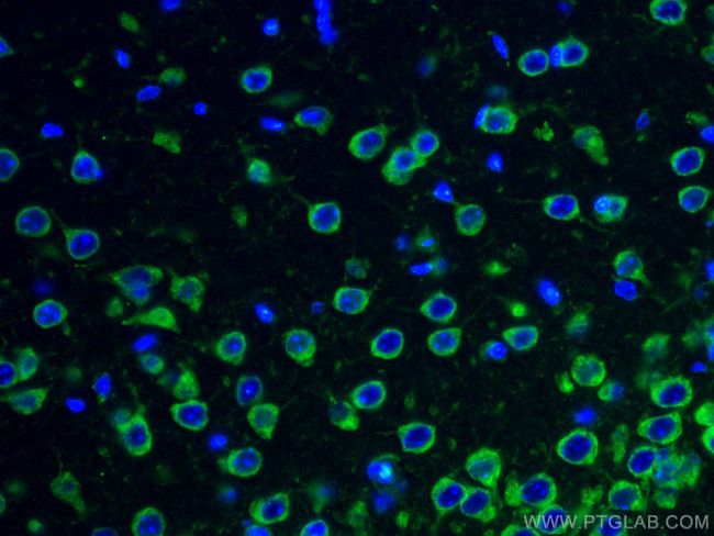 FXR1 Antibody in Immunohistochemistry (Paraffin) (IHC (P))