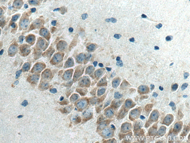 FXR1 Antibody in Immunohistochemistry (Paraffin) (IHC (P))