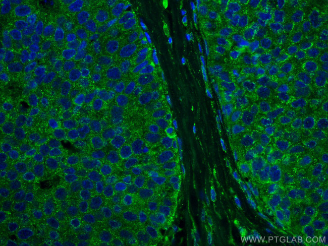 DAPK1 Antibody in Immunohistochemistry (Paraffin) (IHC (P))