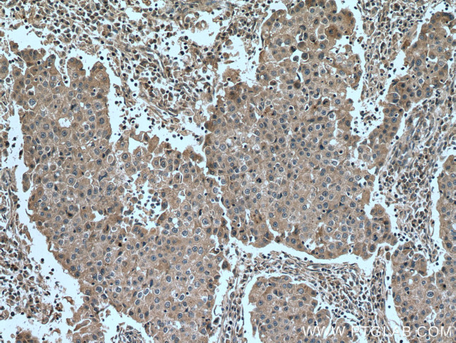 DAPK1 Antibody in Immunohistochemistry (Paraffin) (IHC (P))