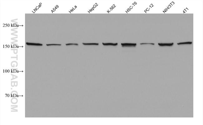 DAPK1 Antibody in Western Blot (WB)