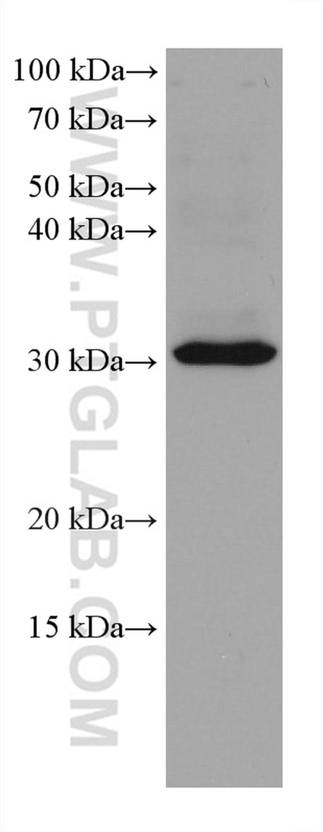 SLC25A42 Antibody in Western Blot (WB)