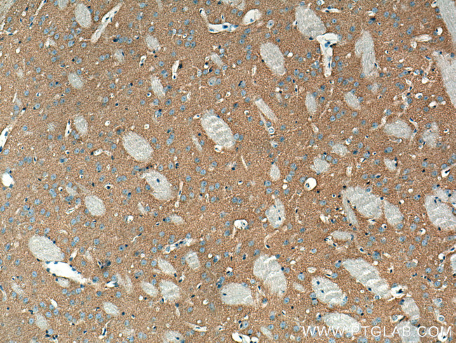 VAMP2 Antibody in Immunohistochemistry (Paraffin) (IHC (P))