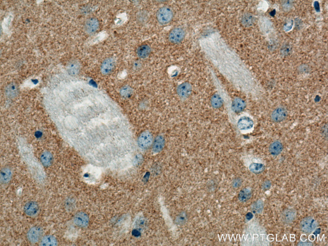 VAMP2 Antibody in Immunohistochemistry (Paraffin) (IHC (P))