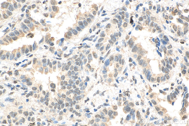 ID1 Antibody in Immunohistochemistry (Paraffin) (IHC (P))