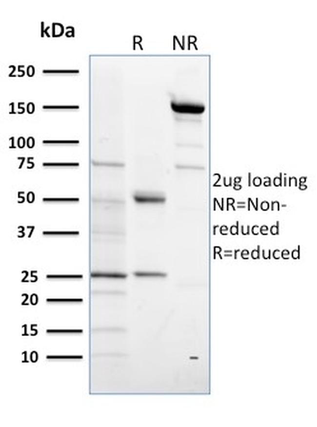 Sulfotransferase family 1E, estrogen-preferring, member 1 Antibody in SDS-PAGE (SDS-PAGE)
