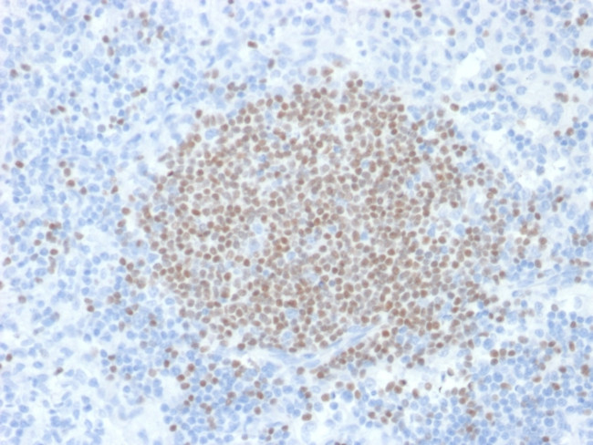 Sulfotransferase family 1E, estrogen-preferring, member 1 Antibody in Immunohistochemistry (Paraffin) (IHC (P))