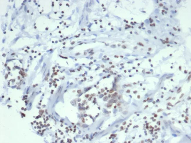 Sulfotransferase family 1E, estrogen-preferring, member 1 Antibody in Immunohistochemistry (Paraffin) (IHC (P))