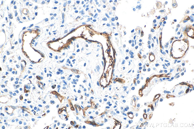 THBD Antibody in Immunohistochemistry (Paraffin) (IHC (P))