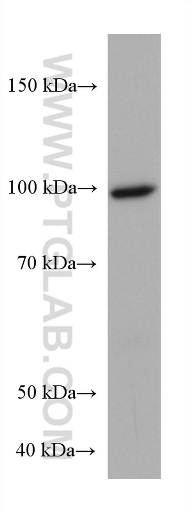 PDE6A Antibody in Western Blot (WB)