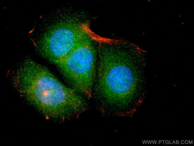 LMCD1 Antibody in Immunocytochemistry (ICC/IF)