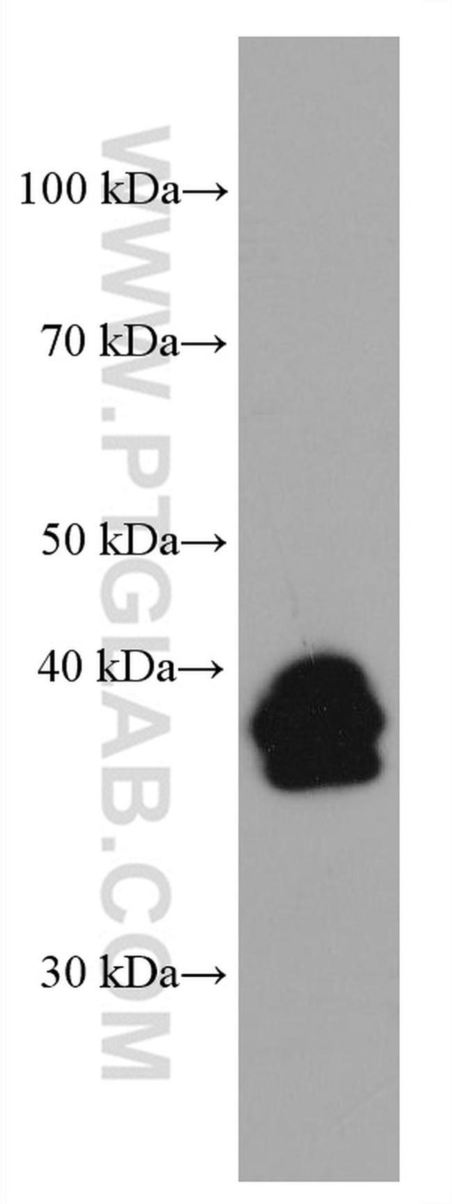 LMCD1 Antibody in Western Blot (WB)