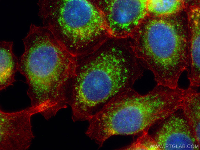 OXCT1 Antibody in Immunocytochemistry (ICC/IF)