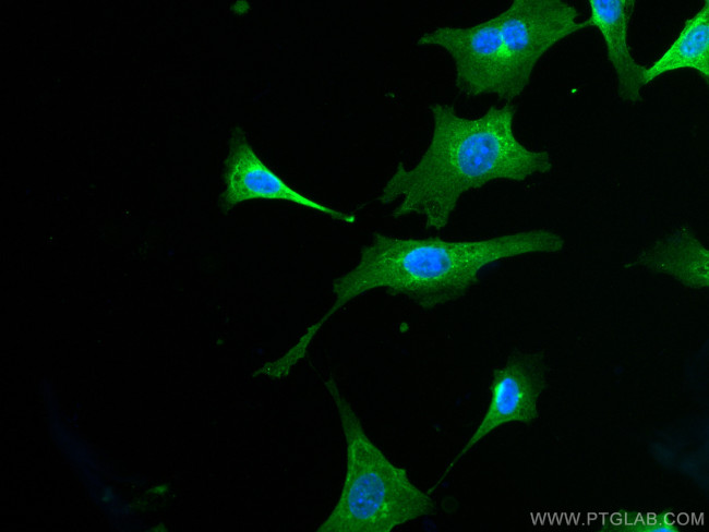 RAB1B Antibody in Immunocytochemistry (ICC/IF)