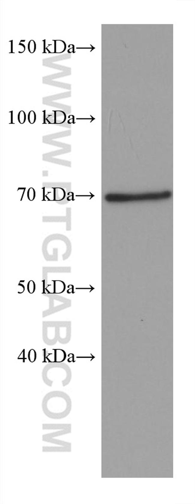 SH3BP5 Antibody in Western Blot (WB)