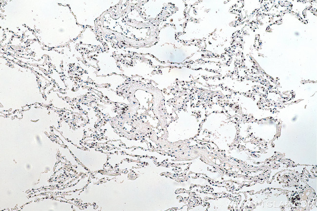 HNRNPA1 Antibody in Immunohistochemistry (Paraffin) (IHC (P))