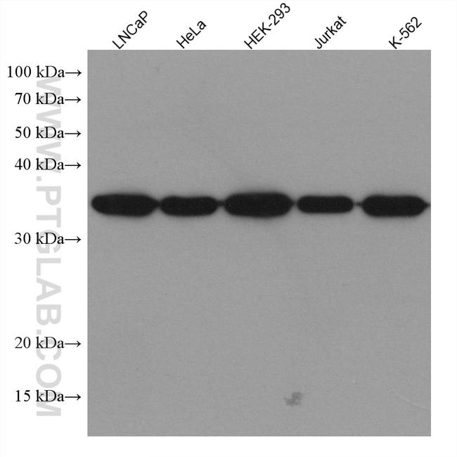 HNRNPA1 Antibody in Western Blot (WB)