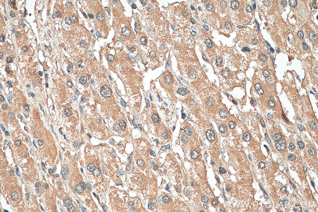 PSMB1 Antibody in Immunohistochemistry (Paraffin) (IHC (P))