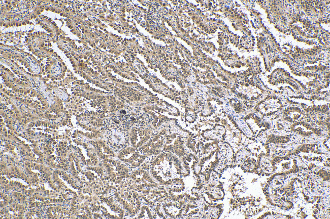 RUVBL2 Antibody in Immunohistochemistry (Paraffin) (IHC (P))