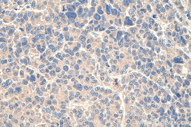 AFP Antibody in Immunohistochemistry (Paraffin) (IHC (P))