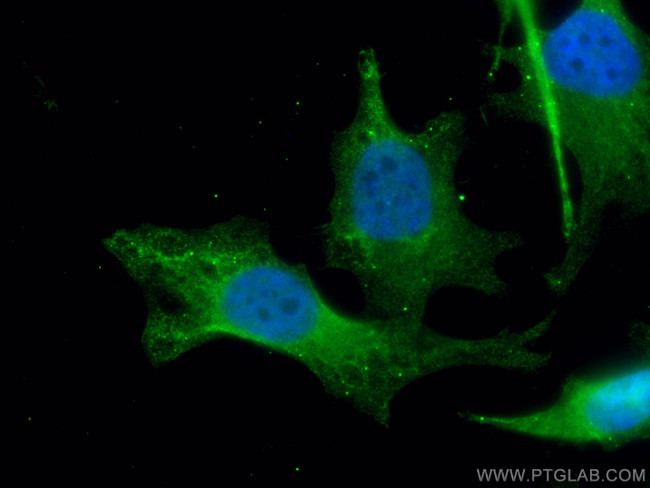 EFTUD2 Antibody in Immunocytochemistry (ICC/IF)