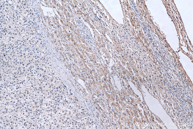 EFTUD2 Antibody in Immunohistochemistry (Paraffin) (IHC (P))