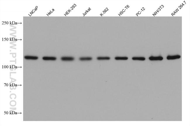 EFTUD2 Antibody in Western Blot (WB)