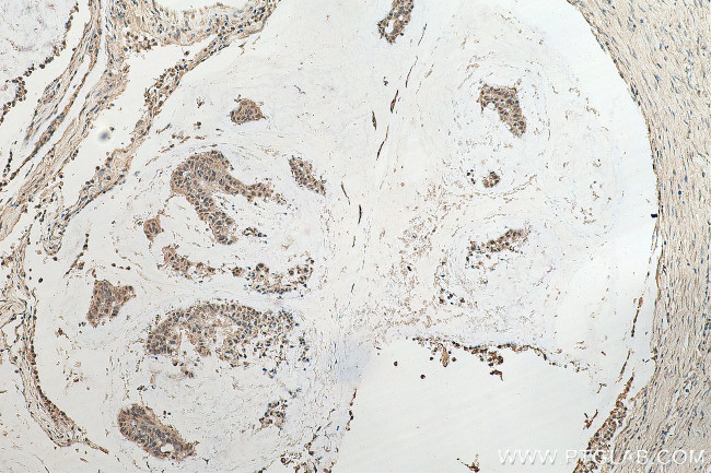 ASH2L Antibody in Immunohistochemistry (Paraffin) (IHC (P))