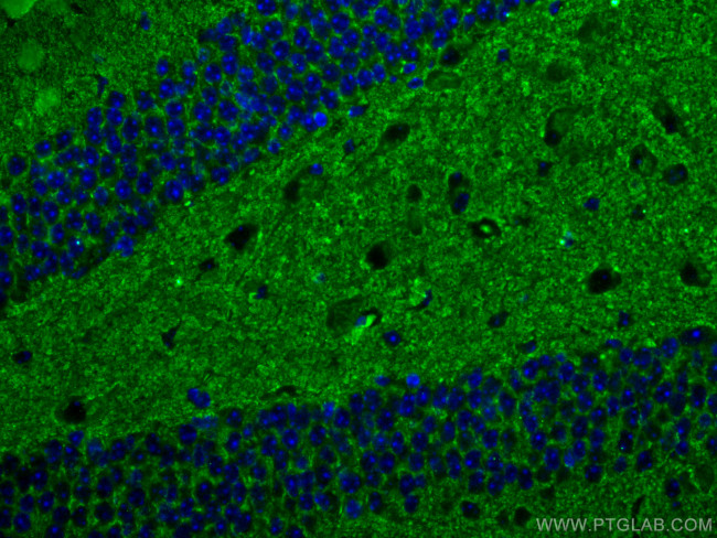 Synaptophysin Antibody in Immunohistochemistry (Paraffin) (IHC (P))