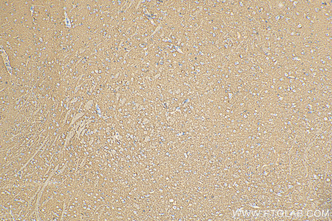 Synaptophysin Antibody in Immunohistochemistry (Paraffin) (IHC (P))