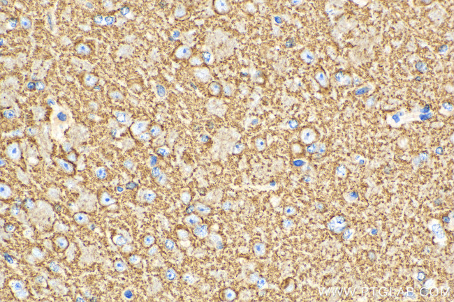 Synaptophysin Antibody in Immunohistochemistry (Paraffin) (IHC (P))