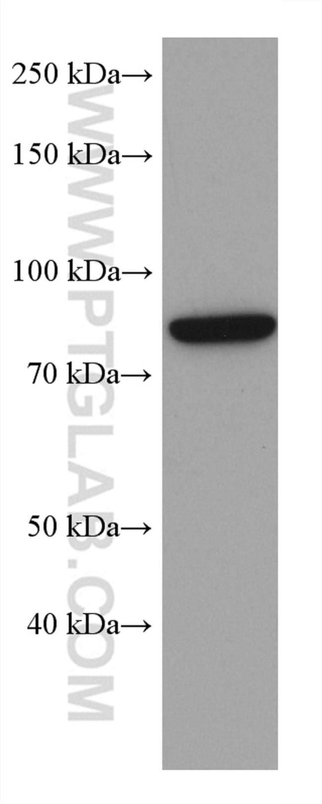 AATF Antibody in Western Blot (WB)