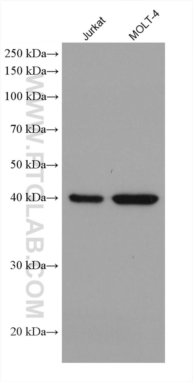 ADA Antibody in Western Blot (WB)