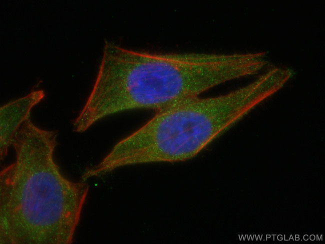 GEMIN8 Antibody in Immunocytochemistry (ICC/IF)