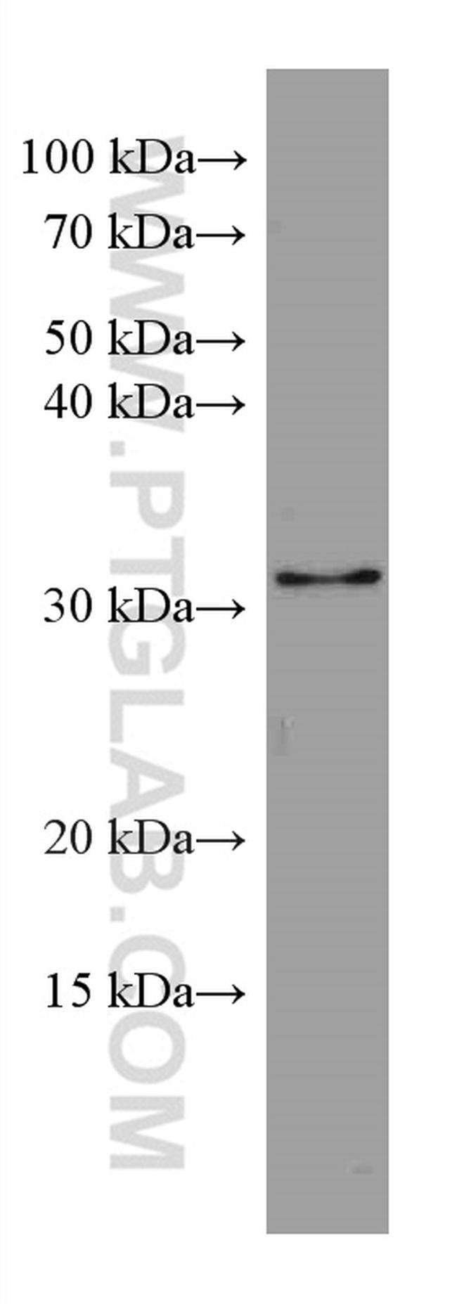 GEMIN8 Antibody in Western Blot (WB)