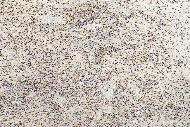 FKBP5 Antibody in Immunohistochemistry (Paraffin) (IHC (P))