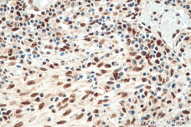 FKBP5 Antibody in Immunohistochemistry (Paraffin) (IHC (P))