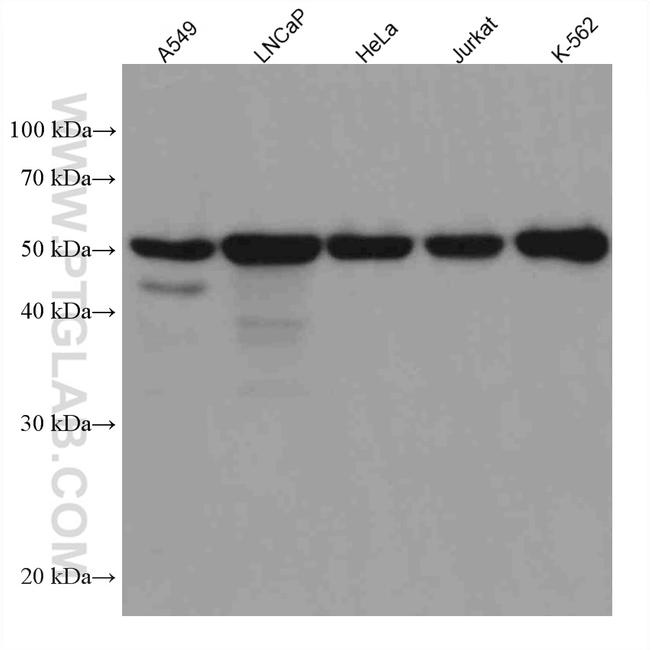 FKBP5 Antibody in Western Blot (WB)