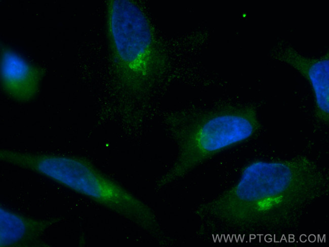 TMED10 Antibody in Immunocytochemistry (ICC/IF)