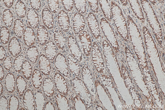 TMED10 Antibody in Immunohistochemistry (Paraffin) (IHC (P))